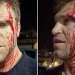 ‘Pretty Little Liars’ Star Keegan Allen Robbed at Gunpoint and Beaten in West Hollywood