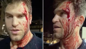‘Pretty Little Liars’ Star Keegan Allen Robbed at Gunpoint and Beaten in West Hollywood